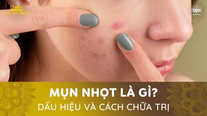 dấu hiệu và cách chữa lành mụn nhọt