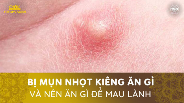 Bị mụn nhọt nên kiêng ăn gì Cham Spa & Massage