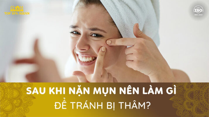 Sau khi nặn mụn nên làm gì để tránh thâm mụn Cham Spa & Massage