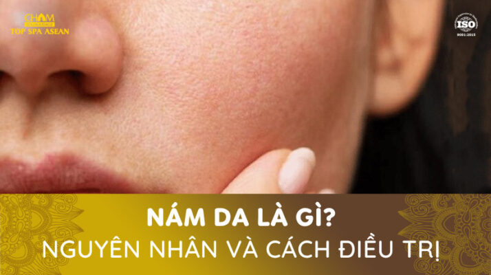 Nám da Cham Spa & Massage