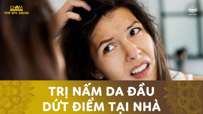 trị nấm da đầu dứt điểm tại nhà