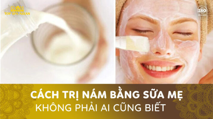Trị nám bằng sữa mẹ Cham Spa & Massage