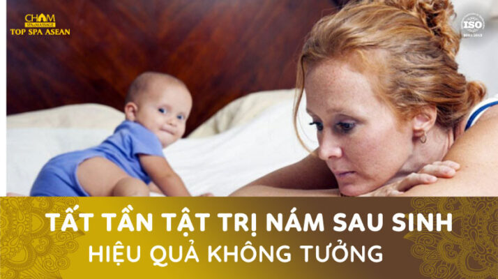 Trị nám sau sinh Cham Spa & Massage