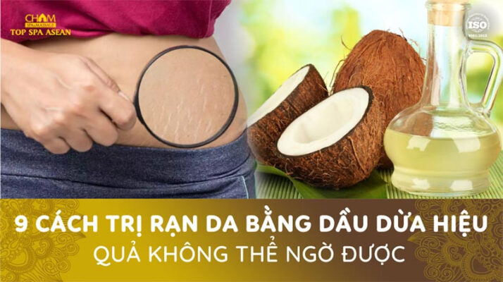 9 cách trị rạn da bằng dầu dừa hiệu quả Cham Spa & Massage