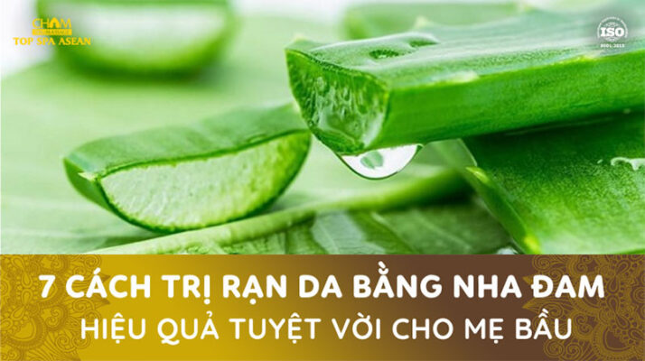 9 cách trị rạn da bằng nha đam hiệu quả Cham Spa & Massage