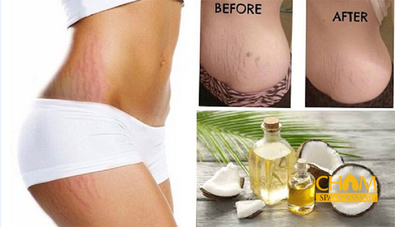 Trị rạn bằng dầu dừa có thực sự hiệu quả Cham Spa & Massage