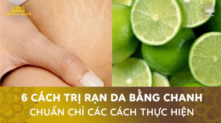 Trị rạn da bằng chanh Cham Spa & Massage
