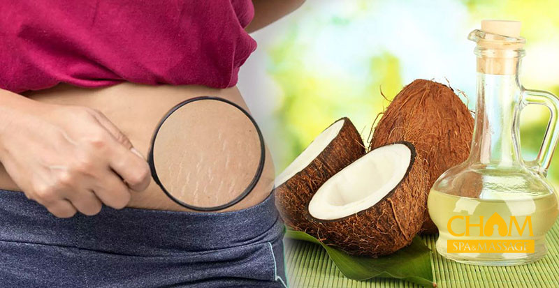 Trị rạn da bằng dầu dừa Cham Spa & Massage