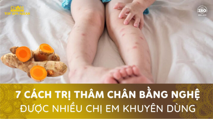 Trị thâm chân bằng nghệ Cham Spa & Massage