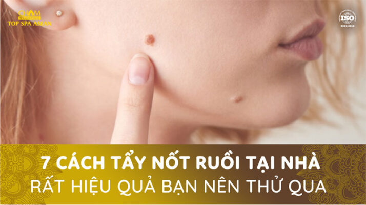 7 cách tẩy nốt ruồi tại nhà hiệu quả Cham Spa & Massage
