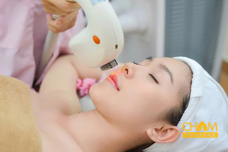 Triệt ria mép bằng công nghệ IPL tại Cham Spa & Massage