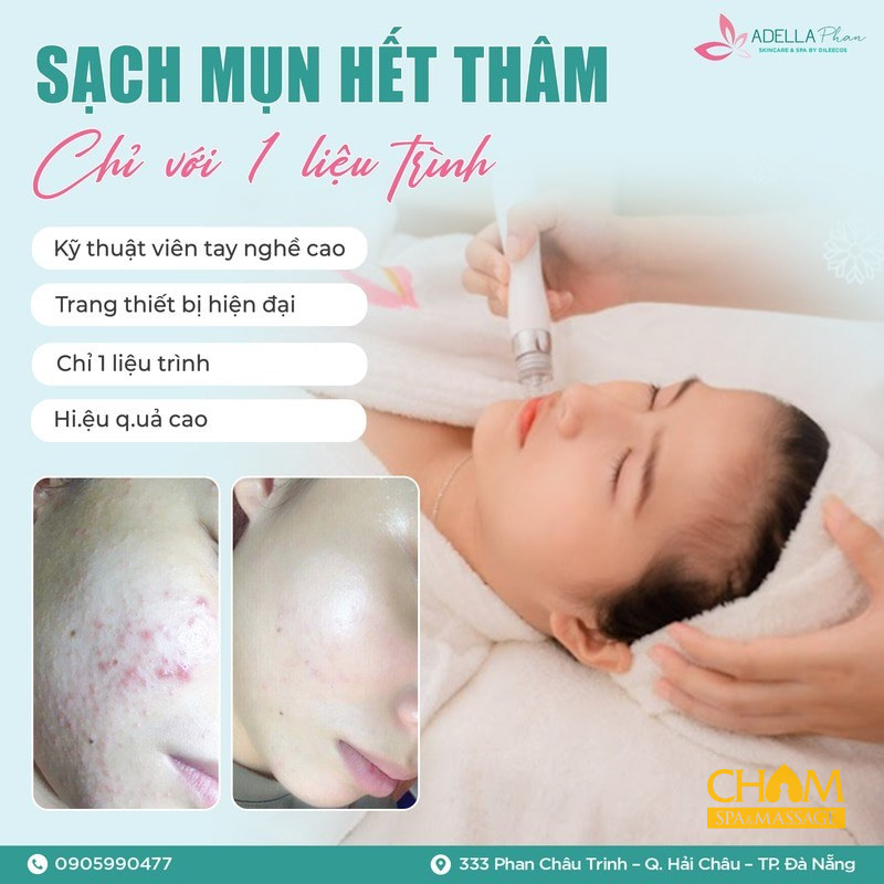 Adella – Clinic & Spa với công nghệ trị mụn Oxy – Led – IPL Elight