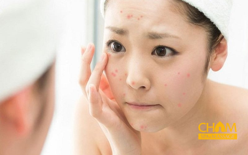 Có nên đi spa trị mụn không