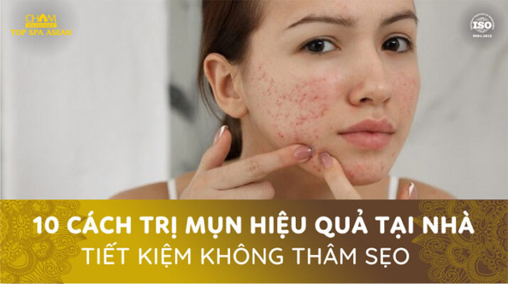 10 cách trị mụn hiệu quả tại nhà tiết kiệm không thâm sẹo