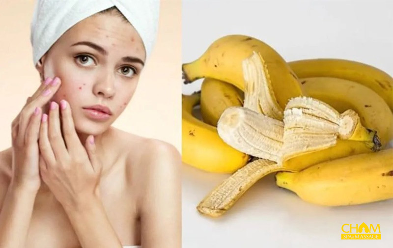 10 Cách trị mụn trứng cá từ nguyên liệu ở nhà hiệu quả cao