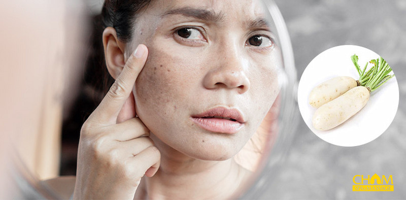 Cách trị tàn nhang