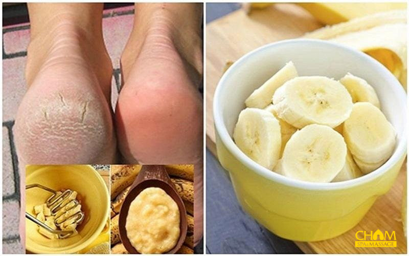 Cách trị nứt gót chân